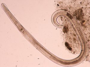 Oxiuri (Enterobius vermicularis)